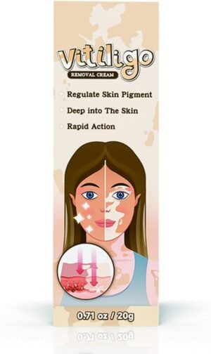Natural Vitiligo Cream