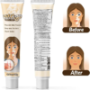 Natural_Vitiligo_Cream_3 Natural Vitiligo Cream