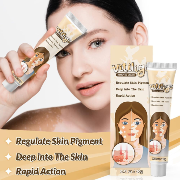 Natural_Vitiligo_Cream_4 Natural Vitiligo Cream