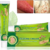 image1_5df1517f-0407-4276-97cb-f1512ba6a885 Eczema Cream Herbal Antibacterial Ointment 20g