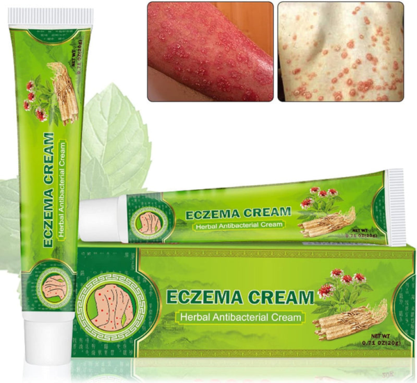 image1_5df1517f-0407-4276-97cb-f1512ba6a885 Eczema Cream Herbal Antibacterial Ointment 20g