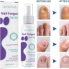 image1_ec665489-1372-4ec3-9a78-b3f97be7a512 Extra Strong Nail Fungus Treatment Spray - 100ml