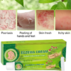 image2_2f75d8e9-41ae-46c2-a857-21c05df2a721 Eczema Cream Herbal Antibacterial Ointment 20g