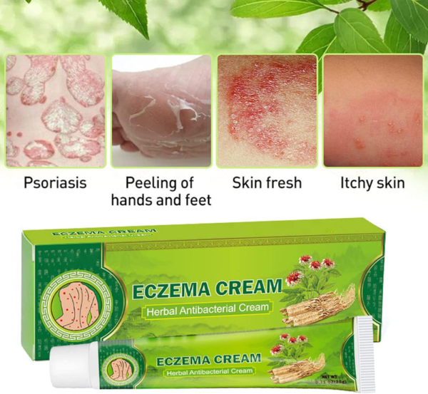 image2_2f75d8e9-41ae-46c2-a857-21c05df2a721 Eczema Cream Herbal Antibacterial Ointment 20g
