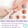 image2_63809fc2-fc3e-42c5-82a1-a64e4bab265a Extra Strong Nail Fungus Treatment Spray - 100ml