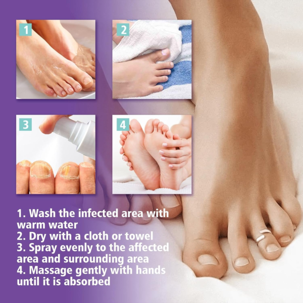 image3_6cd4ce5c-ba96-418e-b5ad-0730729f2818 Extra Strong Nail Fungus Treatment Spray - 100ml