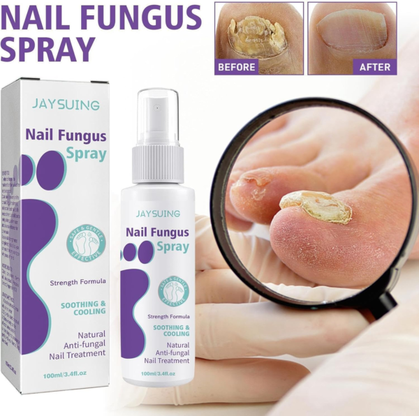 image4_989a041e-6cd0-48cc-aced-a2feb6bf6cb4 Extra Strong Nail Fungus Treatment Spray - 100ml