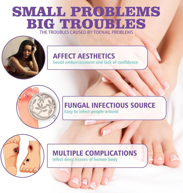 image5_f0f8b9e2-0149-4367-8785-8e7a6e304f70 Extra Strong Nail Fungus Treatment Spray - 100ml
